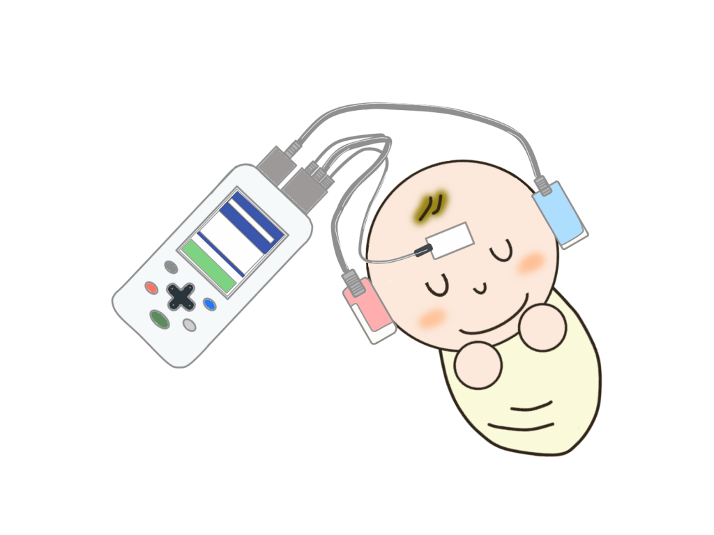 新生児聴覚検査